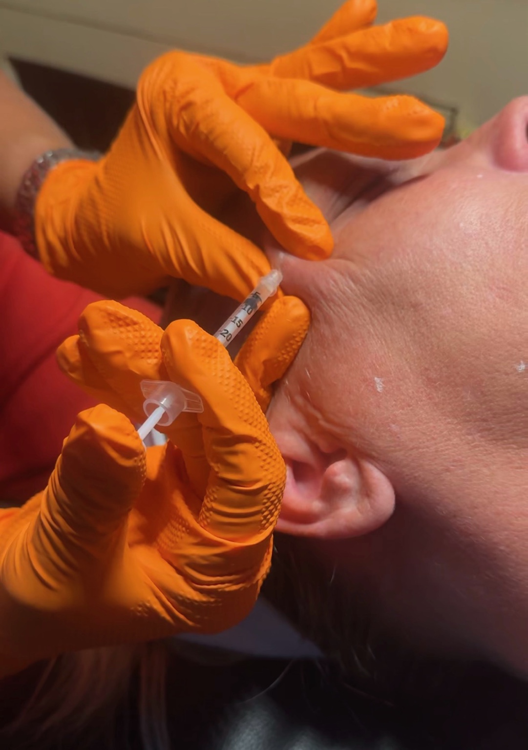 Aesthetics treatment at Glow Lounge